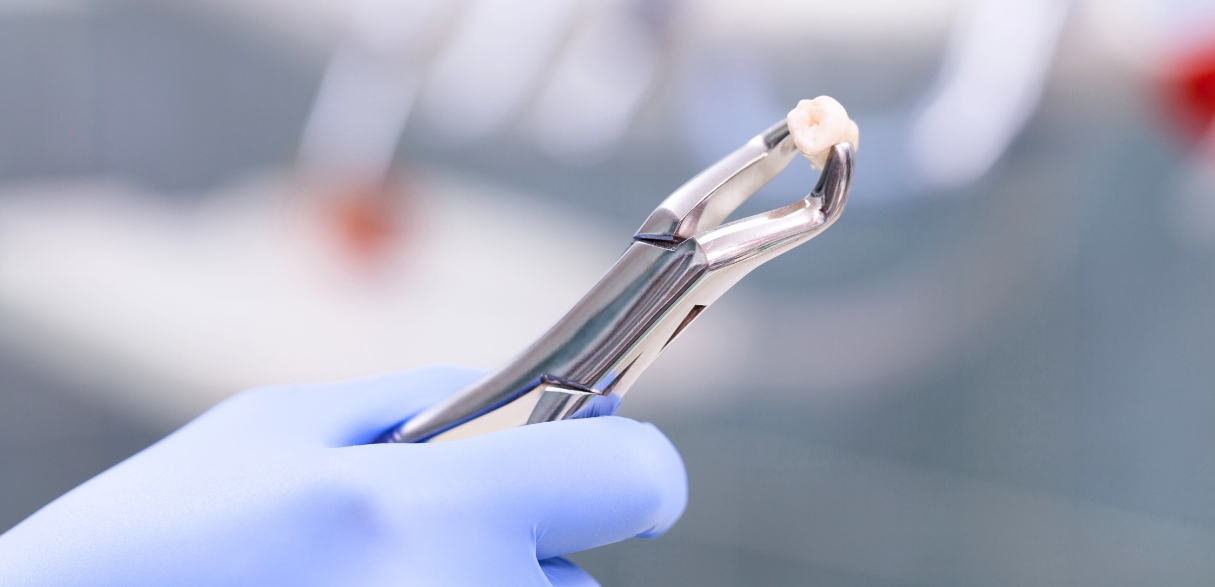 Managing Dental Anxiety How to Overcome Fear of Tooth Extractions