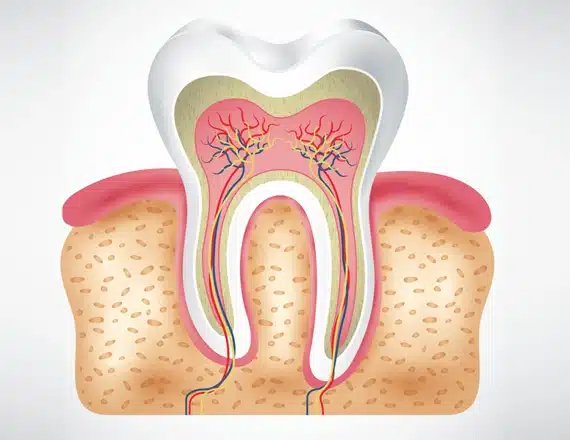 Turn to Us for Effective Root Canal Treatment